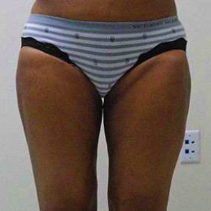 B&A