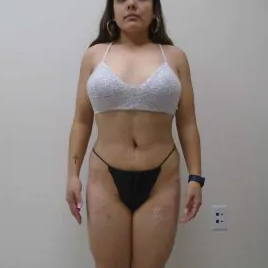 B&A