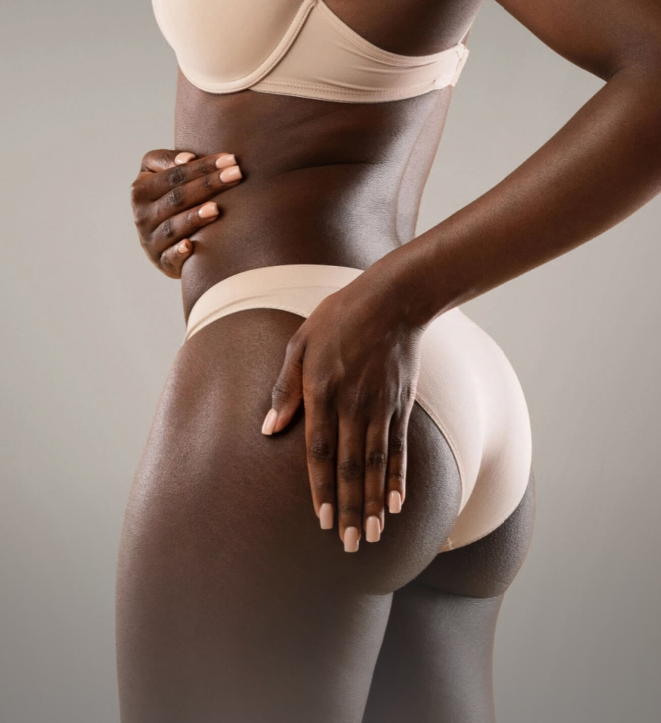 Cellulite