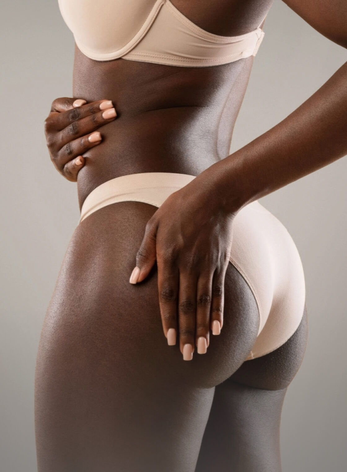 Cellulite