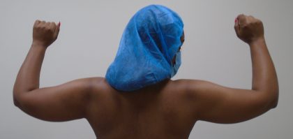 Arm Liposuction Before & After Patient #410