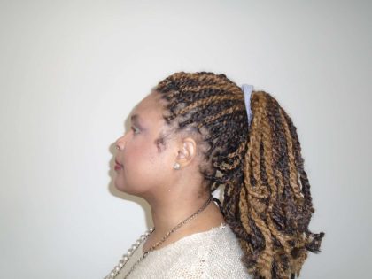 Chin Before & After Patient #467
