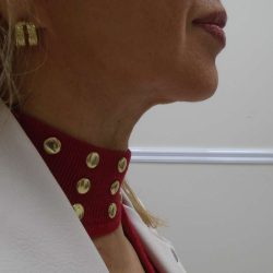 Chin Before & After Patient #476