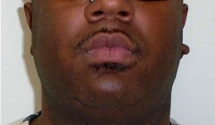 Chin Before & After Patient #299