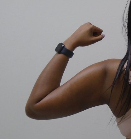 Arm Liposuction Before & After Patient #1075