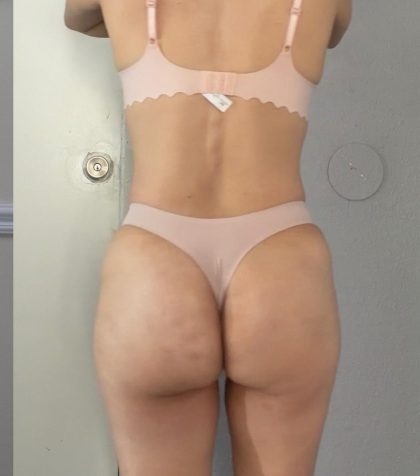 Lipo 360 Before & After Patient #1458